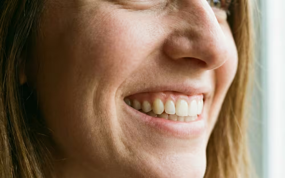 Beyond Aesthetics 5 Health Benefits of Straightening Your Smile with Braces